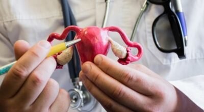 Habitos saludables y Endometriosis